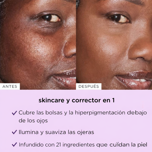 Blur™: Cubre las manchas que te deja el verano y líneas de expresión